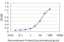 MSMB / MSP Antibody (clone 3B11)