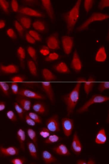 UHRF1 Antibody