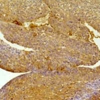 EPHA1 / EPH Receptor A1 Antibody