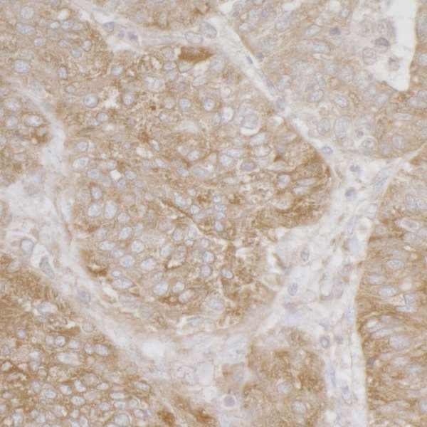 RPS3A / Ribosomal Protein S3A Antibody (aa1-50)