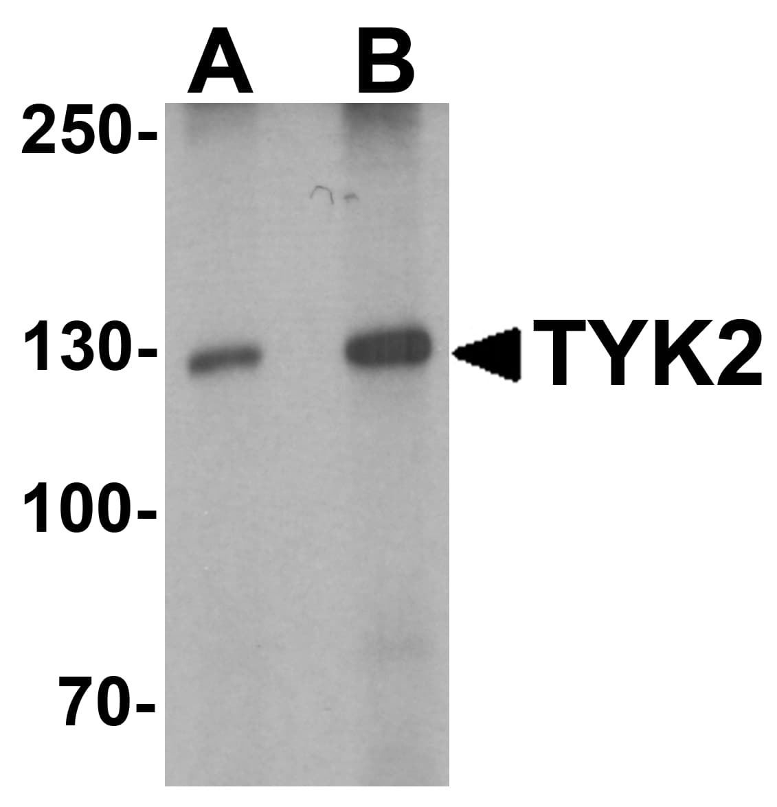 IHC-plus™ Polyclonal Rabbit anti-Human TYK2 Antibody (IHC, WB)