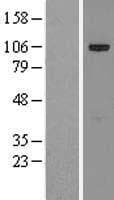 KIAA1524 / p90 Autoantigen Protein (Over-Expression Lysate Myc-DDK (Flag))