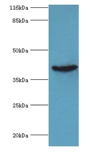 ADA / Adenosine Deaminase Antibody (aa157-343)