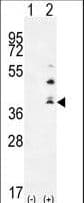 Polyclonal Rabbit anti-Human TNFSF15 / TL1A / VEGI Antibody (aa148-175, IF, WB)