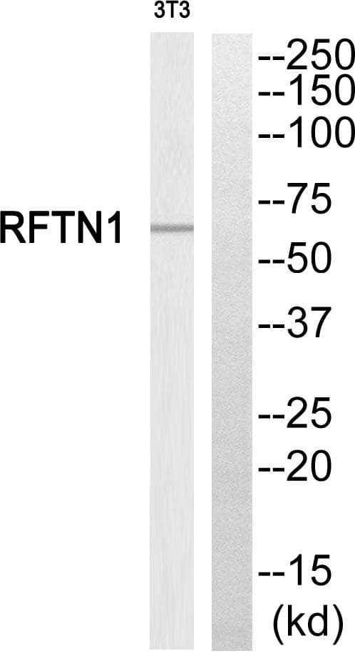 Polyclonal Rabbit anti-Human REPS1 Antibody (WB)