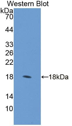 RCBTB2 Antibody (aa394-519)