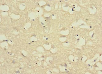 Polyclonal Rabbit anti-Human C11orf1 Antibody