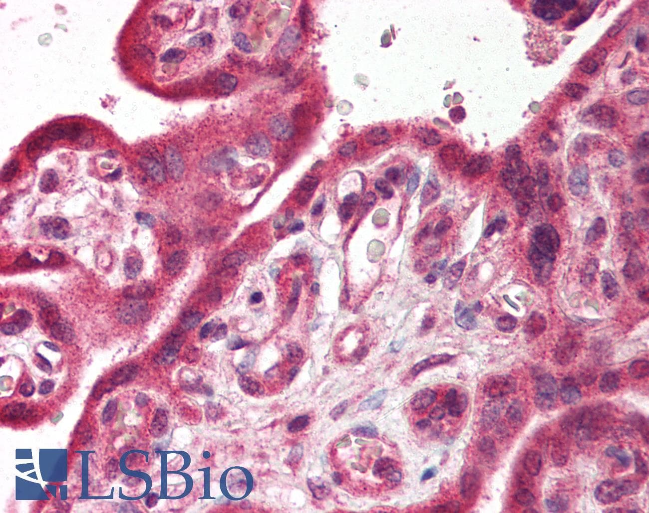 IHC-plus™ TRPC6 Antibody