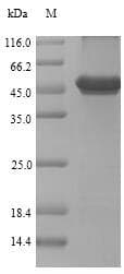 Renilla reniformis Coelenterazine h 2-monooxygenase Protein (Recombinant 10His-SUMO, N-terminus + Myc, C-terminus)