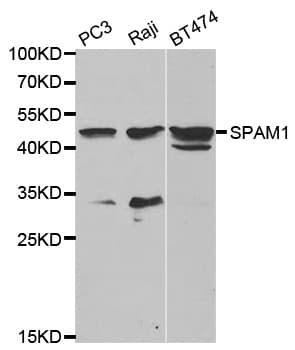 SPAM1 / PH20 Antibody