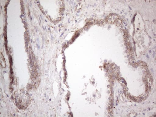Monoclonal Mouse anti-Human CLU / Clusterin Antibody (clone OTI5D3, aa23-227, IHC, WB)