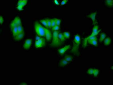 Polyclonal Rabbit anti-Human DTNBP1 / Dysbindin Antibody (IHC, IF)