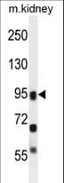 ALOXE3 Antibody (aa223-252)
