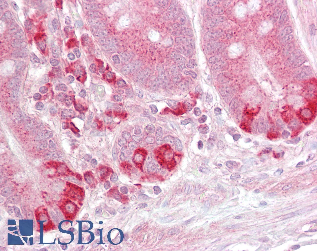 IHC-plus™ Polyclonal Goat anti-Human TRAF1 Antibody (aa270-282, IHC, WB)