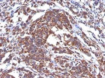 Vimentin Antibody (clone LN-6)