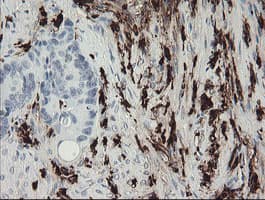 F13A1 / Factor XIIIa Antibody (clone OTI3E3, Carrier-free)