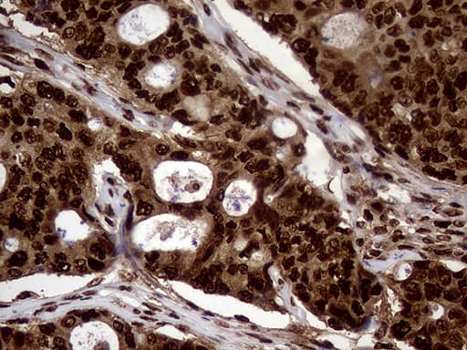 Monoclonal Mouse anti-Human TALDO1 / Transaldolase 1 Antibody (clone OTI1A5, IHC, WB)