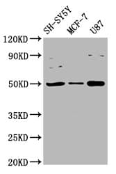 IGHM / IgM Antibody
