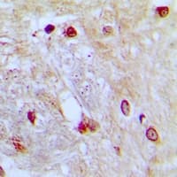 Polyclonal Rabbit anti-Human ZNF435 / ZSCAN16 Antibody (IHC, IF, WB)