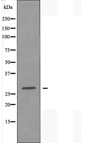 Polyclonal Rabbit anti-Human NDUFV2 Antibody (IF, WB)