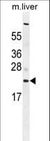 C1QL3 Antibody (aa22-50)