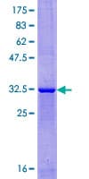 Human XAGE1E Protein (Recombinant GST)