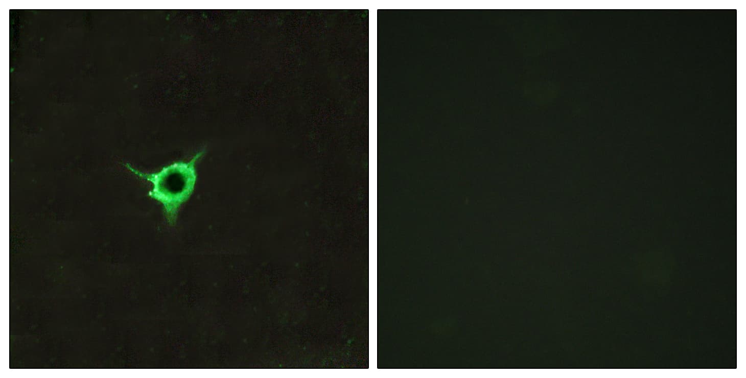 Polyclonal Rabbit anti-Human CNR1 / CB1 Antibody (aa151-200, IHC, IF, WB)