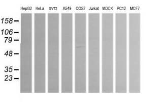 ALDH1A3 Antibody (clone OTI4A3)