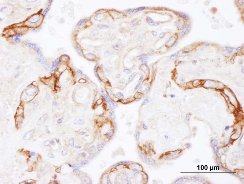 EGFR Antibody (aa1100-1150)