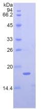 Mouse NPM1 / NPM / Nucleophosmin Protein (Recombinant His)