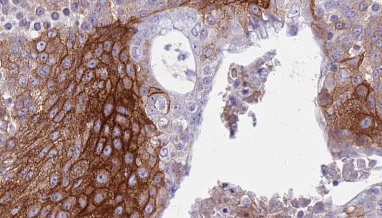 Polyclonal Rabbit anti-Human KCNJ3 / GIRK1 Antibody (IHC, IF, WB)