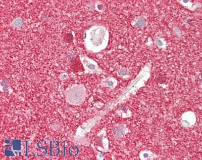 Polyclonal Rabbit anti-Human SNCA / Alpha-Synuclein Antibody (IHC, IF, WB)