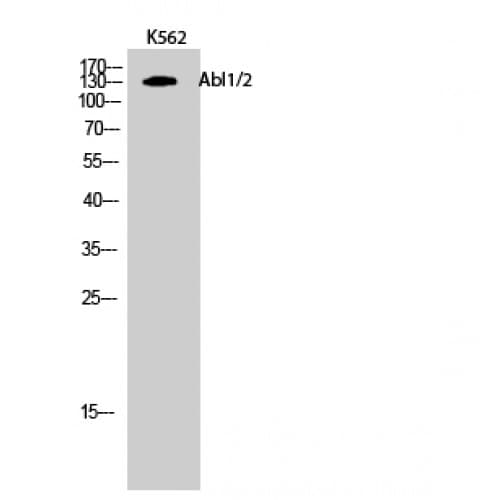Polyclonal Rabbit anti-Human ABL Antibody (380-460 aa, IHC, WB)