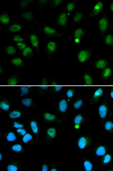 IHC-plus™ DCK / Deoxycytidine kinase Antibody