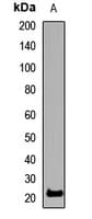 SSX2 Antibody