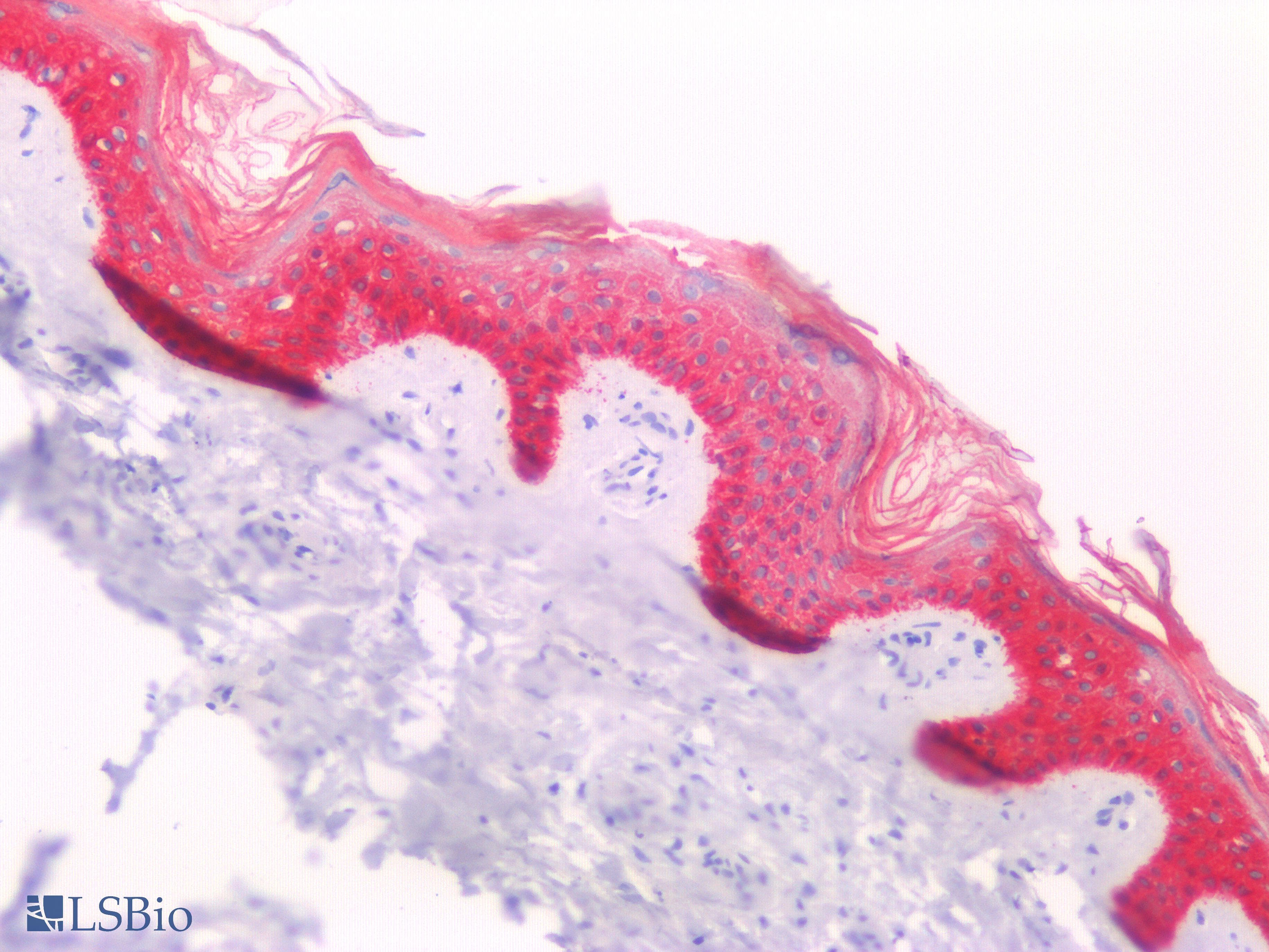 PathPlus™ Keratin, HMW Antibody (clone 34BE12)