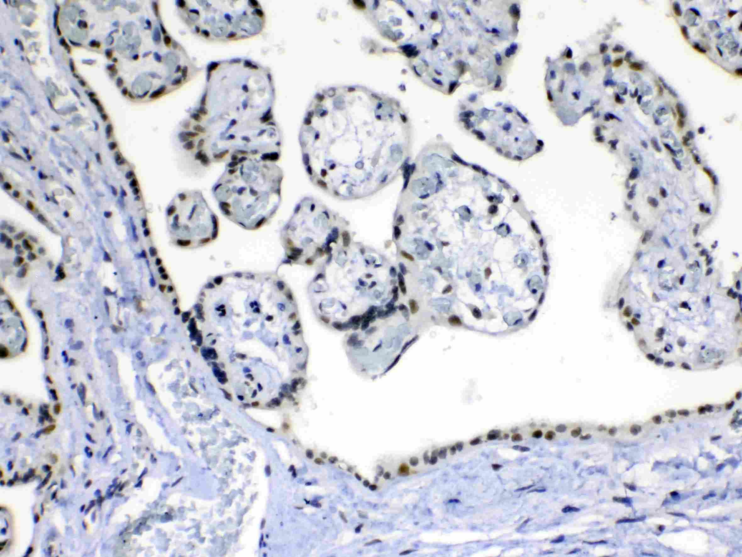 MED15 / ARC105 Antibody
