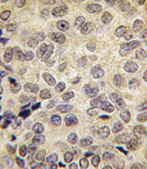 DNMT3B Antibody (aa389-417)