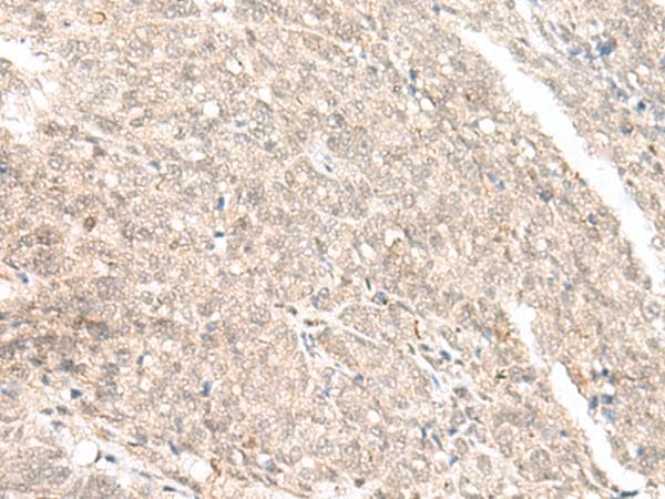 GANC Antibody