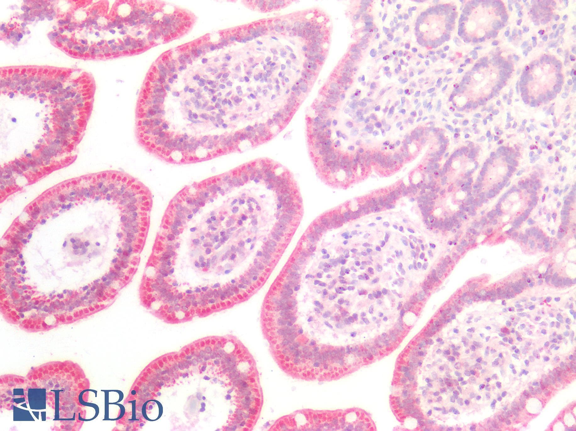 IHC-plus™ TGFBR2 Antibody (aa100-150)