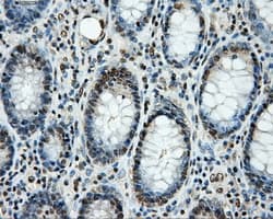 Monoclonal Mouse anti-Human LOX / Lysyl Oxidase Antibody (clone OTI6B11, IHC, IF, WB)