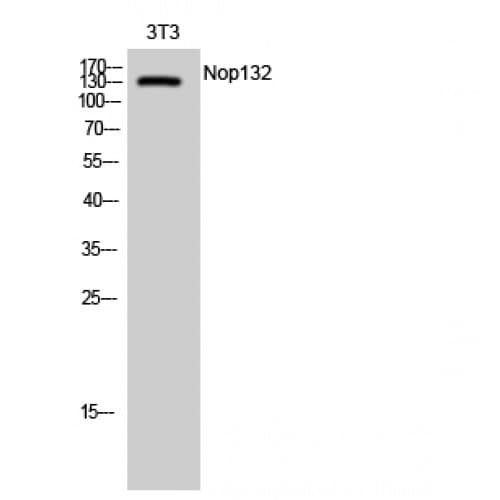 Polyclonal Rabbit anti-Human NOL8 Antibody (1110-1190 aa, C-terminal, IHC, WB)