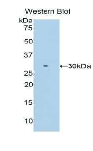 ITLN1 / Omentin Antibody (aa28-270)