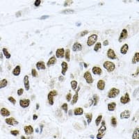 Polyclonal Rabbit anti-Human METTL3 Antibody (IHC, WB)