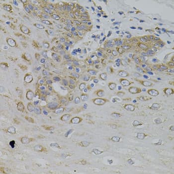IRF1 / MAR Antibody