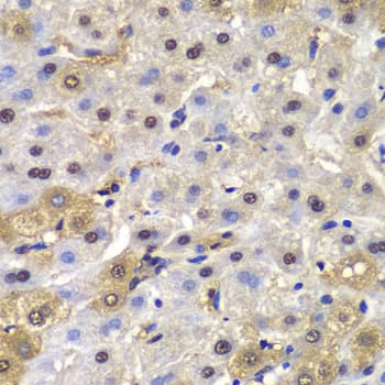 MAD1L1 / MAD1 Antibody