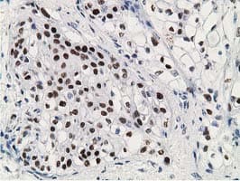 Monoclonal Mouse anti-Human TP53 / p53 Antibody (clone OTI3D5, IHC, IF, WB)