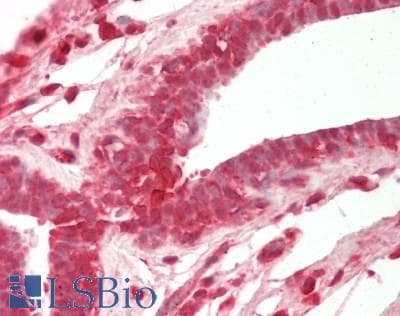 IHC-plus™ Polyclonal Rabbit anti-Human COMP / THBS5 Antibody (IHC, IF, WB)