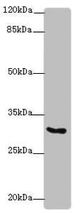 KCNIP2 / KCHIP2 Antibody
