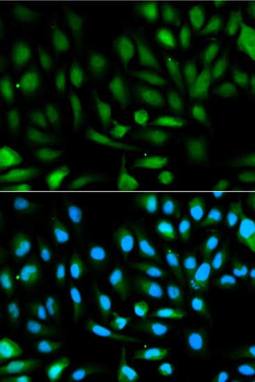 PARK7 / DJ-1 Antibody